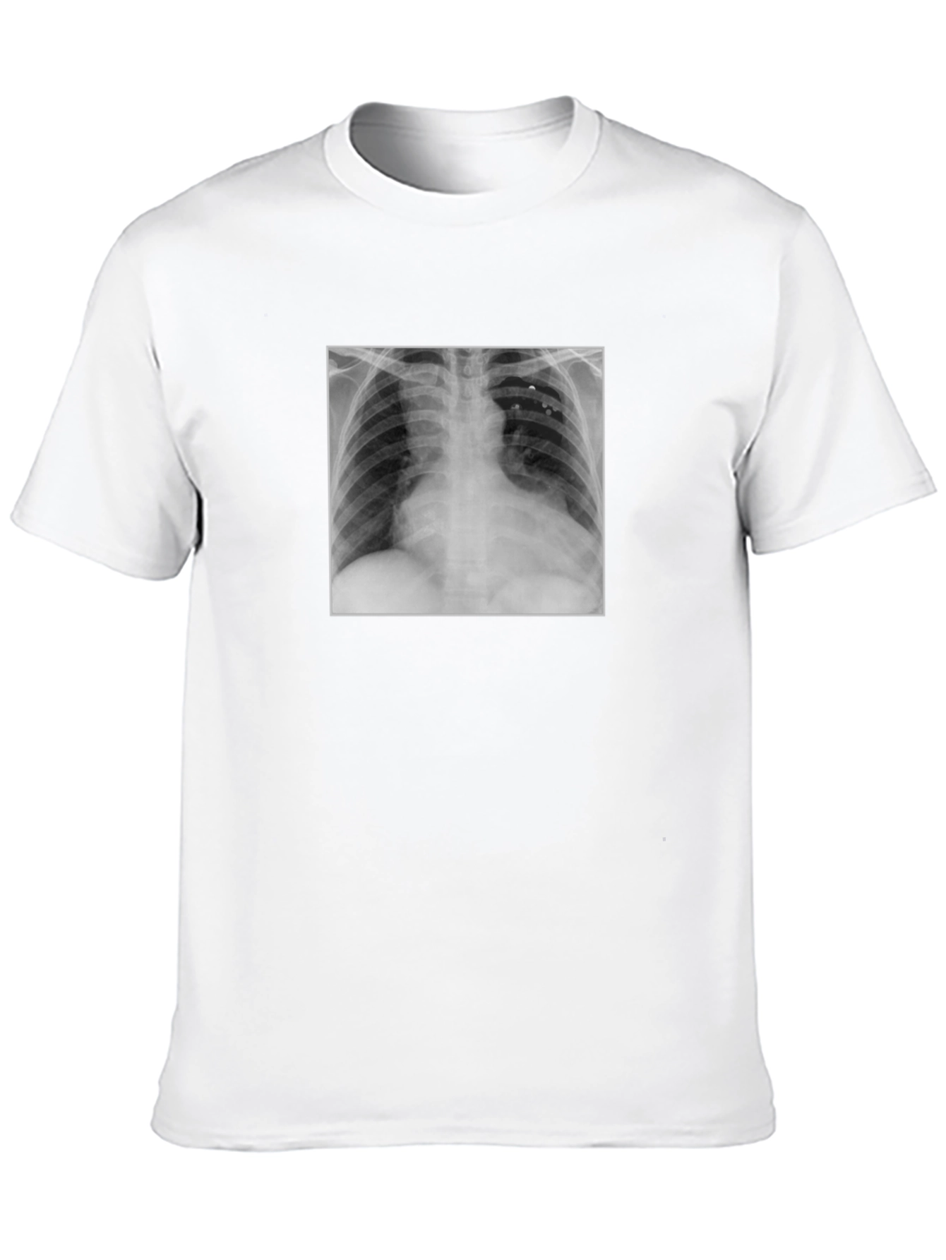 X-Ray Graphic Tee - Medical Humor T-Shirt