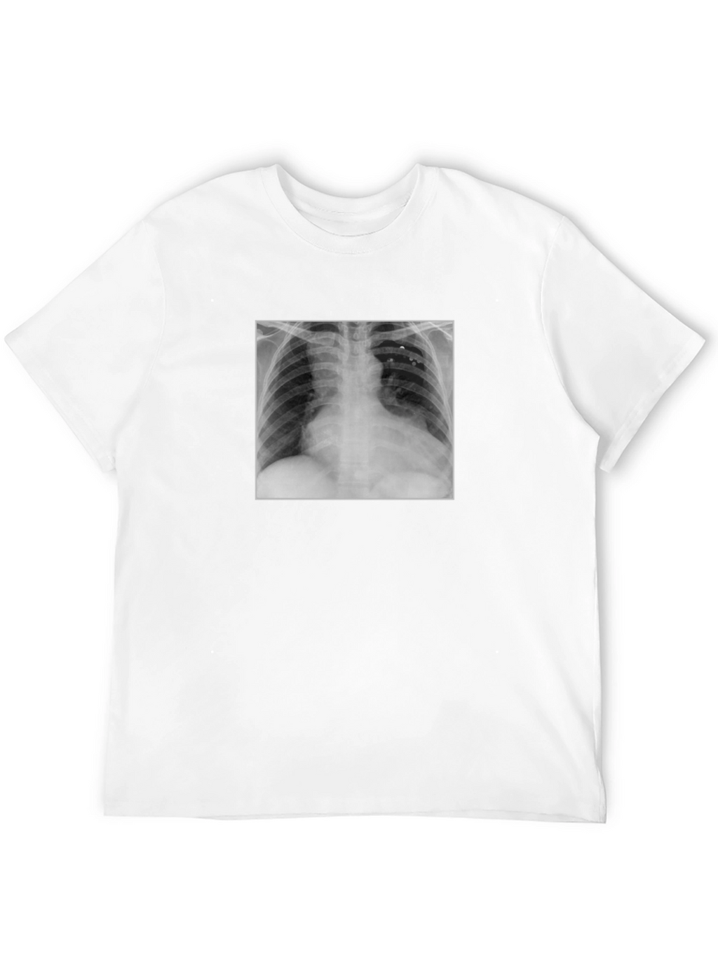 X-Ray Graphic Tee - Medical Humor T-Shirt