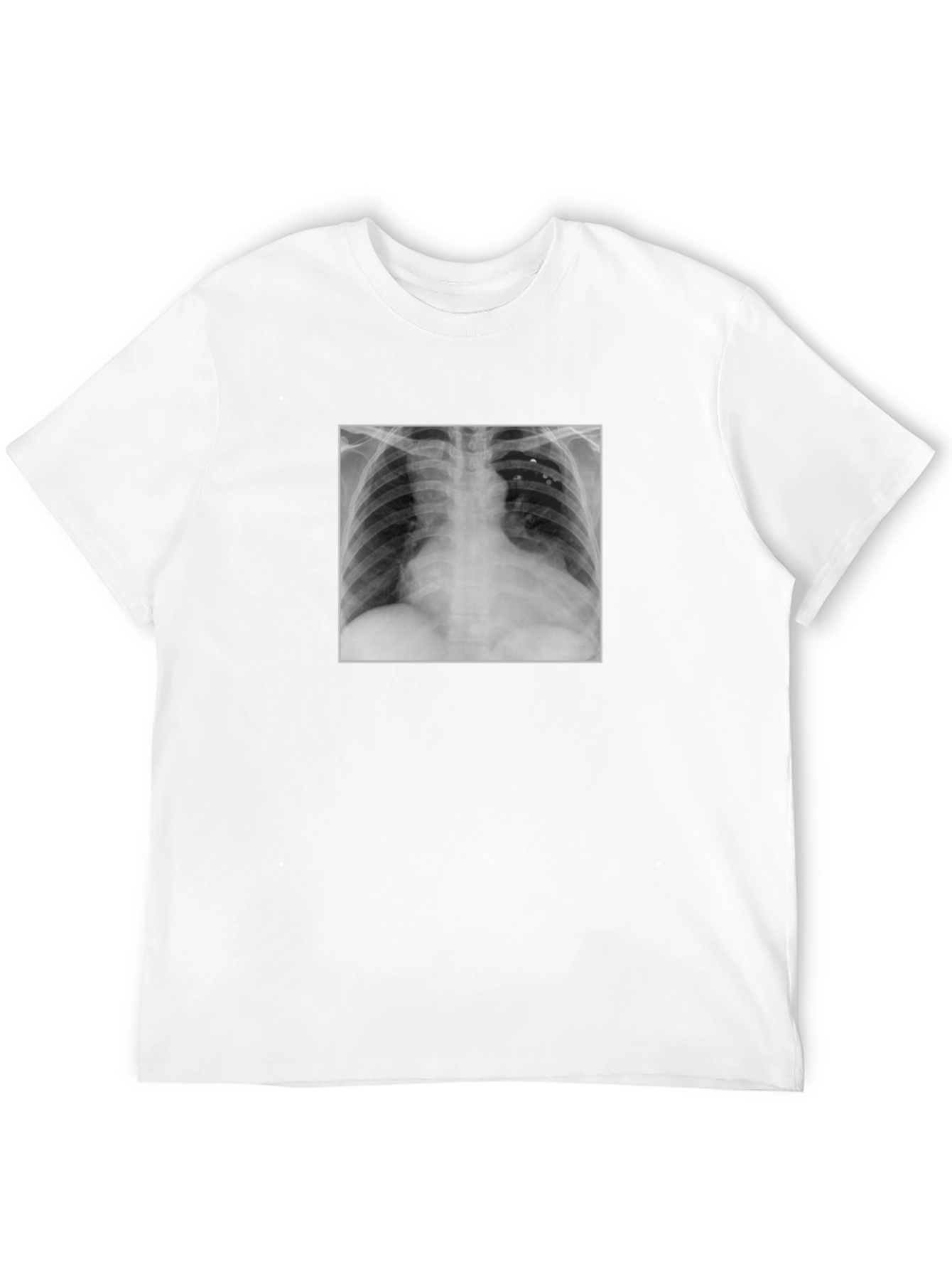 X-Ray Graphic Tee - Medical Humor T-Shirt
