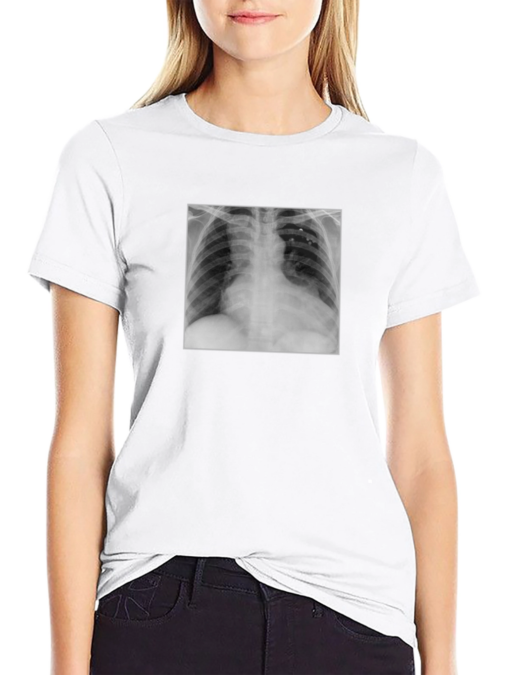 X-Ray Graphic Tee - Medical Humor T-Shirt