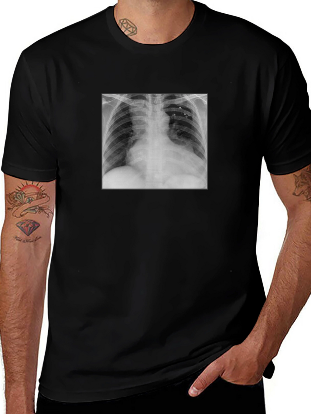 X-Ray Graphic Tee - Medical Humor T-Shirt