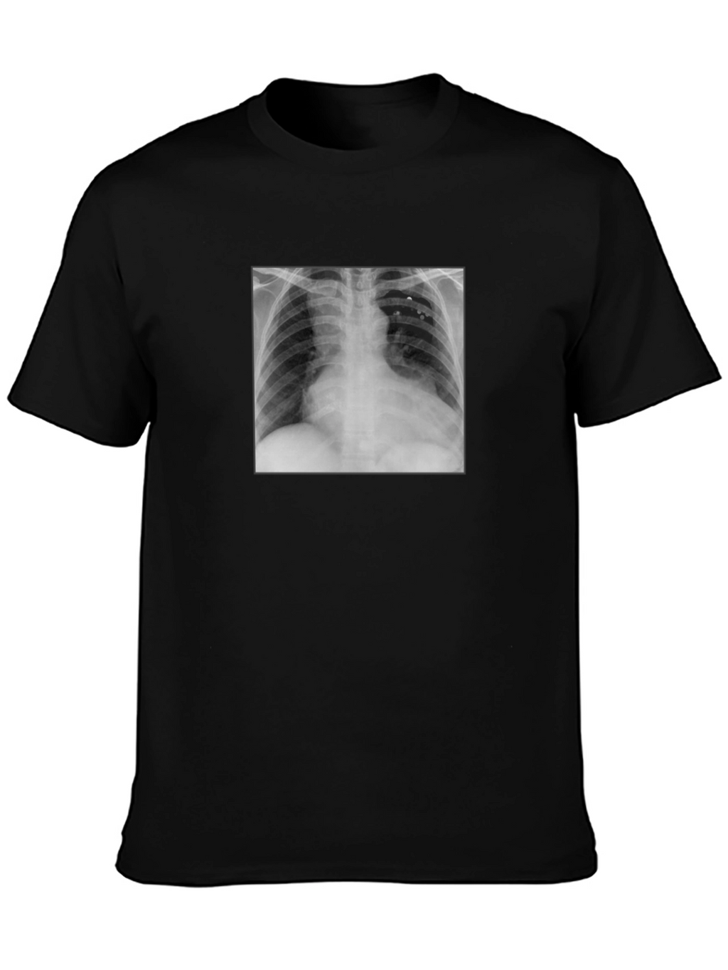 X-Ray Graphic Tee - Medical Humor T-Shirt