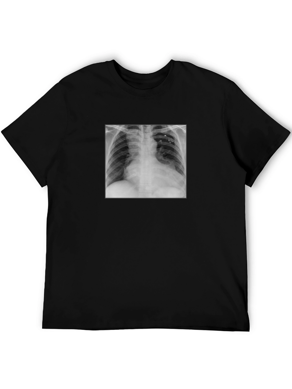 X-Ray Graphic Tee - Medical Humor T-Shirt